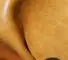557L